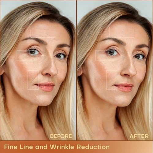 MLAY Professional RF Beauty Machine, Radio Frequency Face Machine with 2 Probes, at Home Radio Frequency Skin Tightening for Lifting