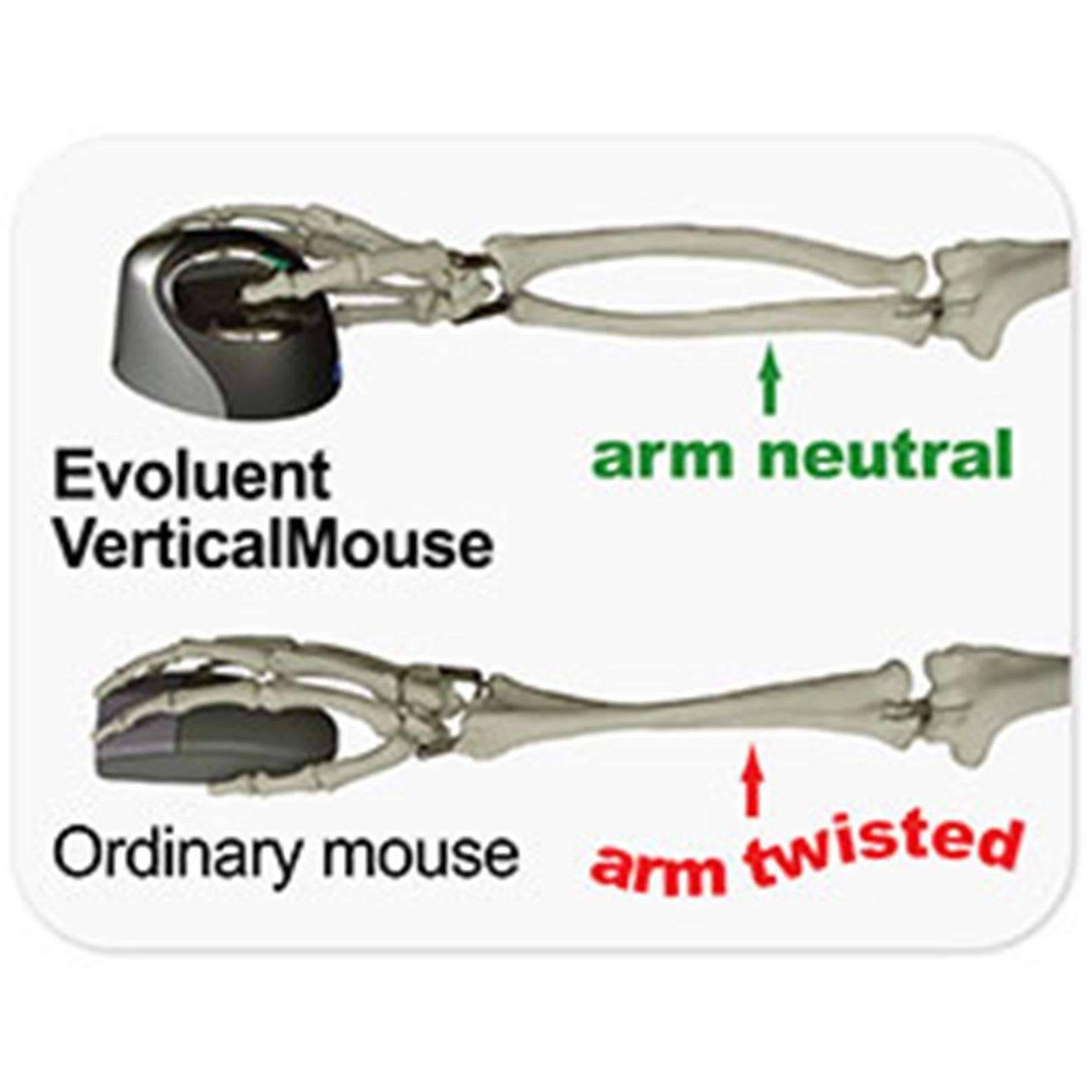Evoluent Mouse VM4RB VerticalMouse 4 Right Bluetooth