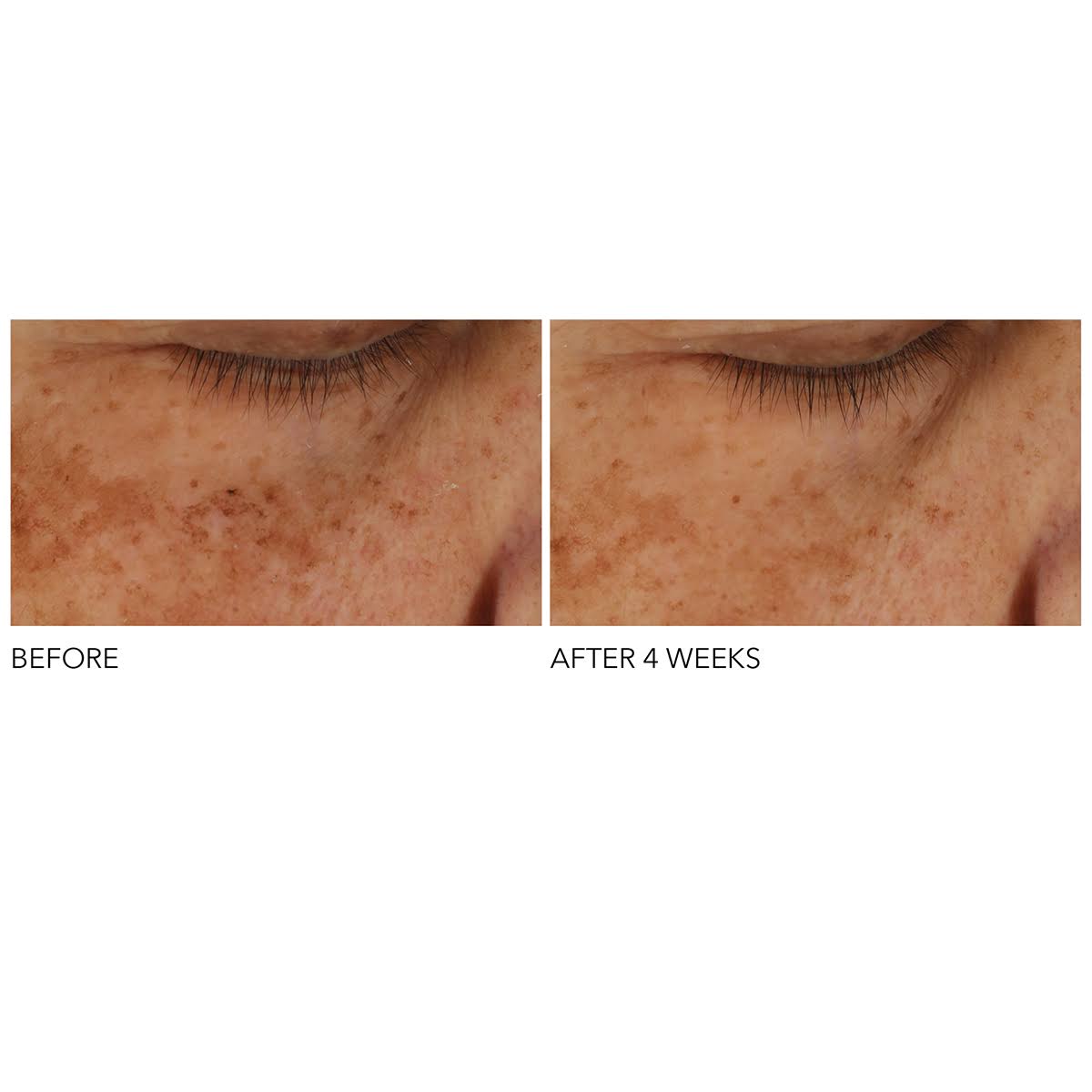 Dr. Dennis Gross Skincare Advanced Retinol + Ferulic Overnight Texture Renewal Peel