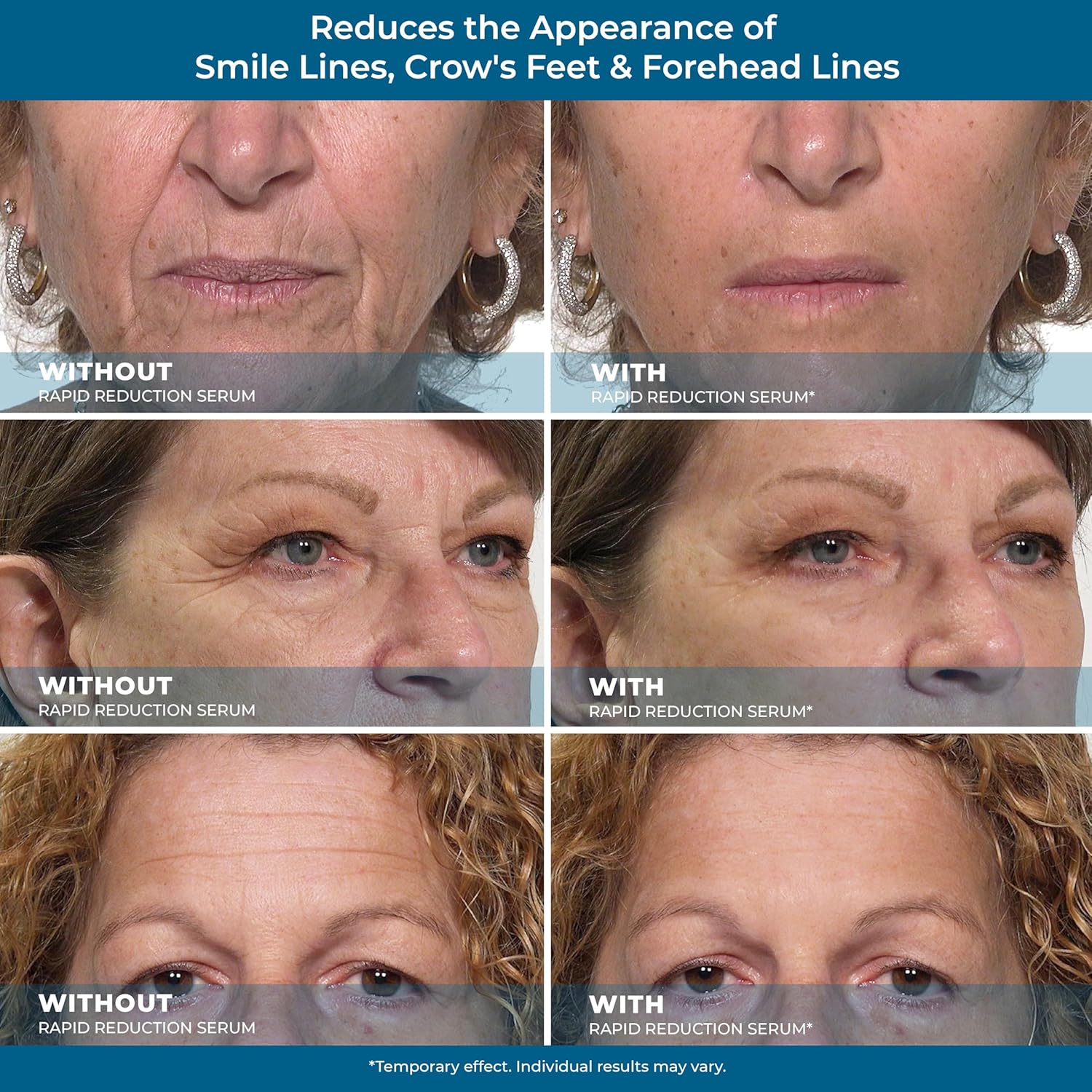 Plexaderm Rapid Reduction Eye Serum - Advanced Formula Anti Aging Visibly Reduces Under-Eye Bags, Wrinkles, Dark Circles