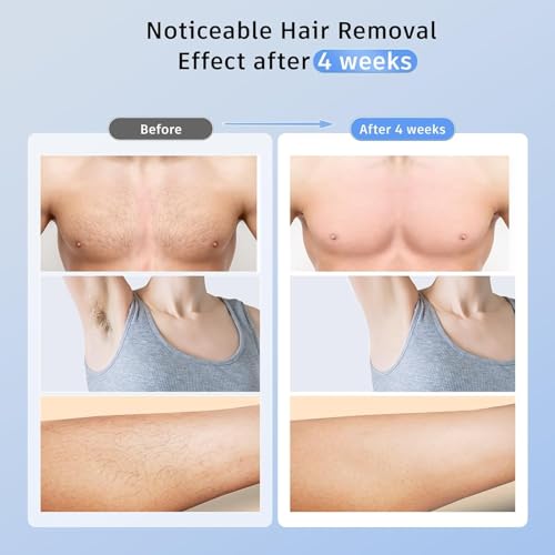 Laser Hair Removal with 5℃ Ice Cooling