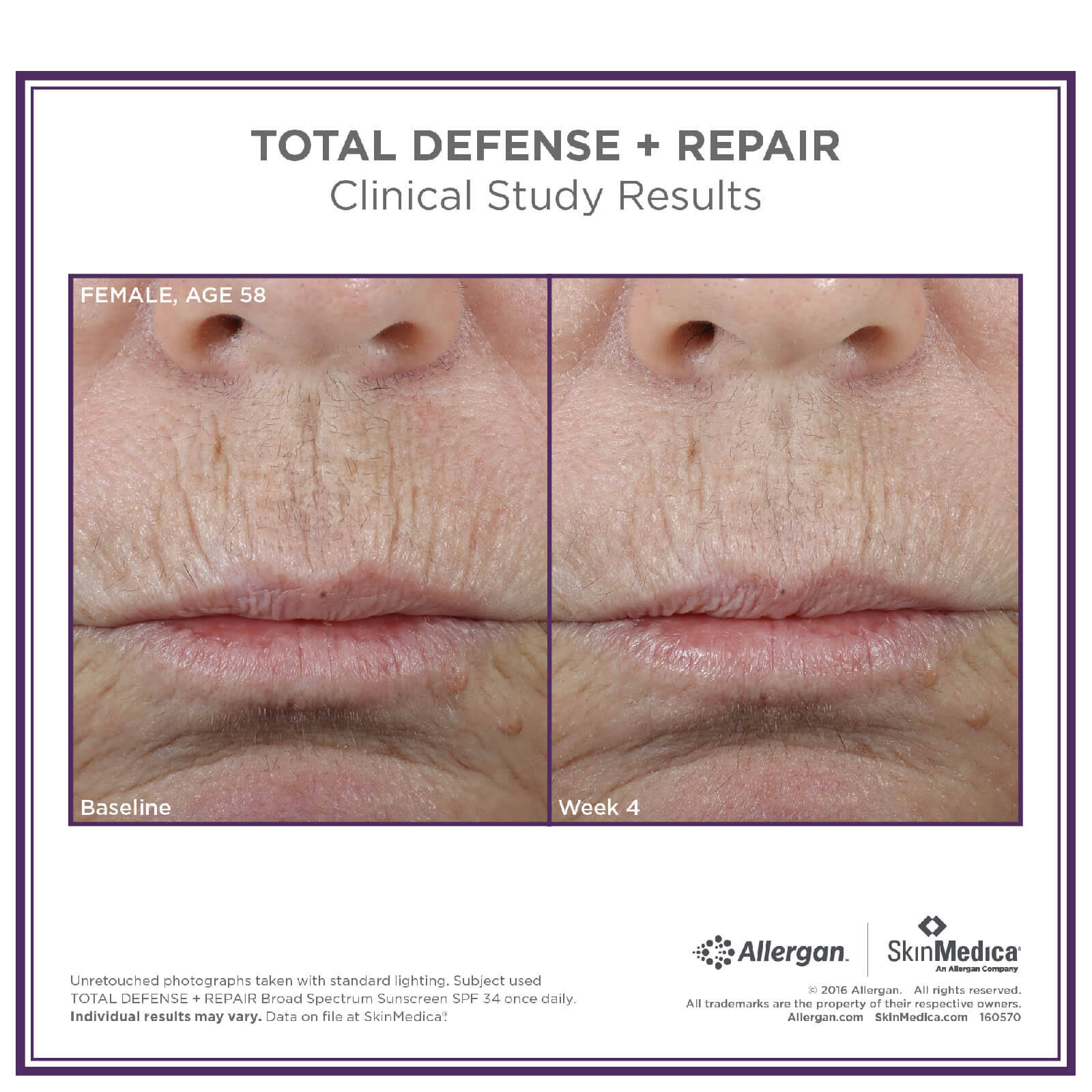 SkinMedica Total Defense + Repair SPF 34 - Tinted (2.3oz)