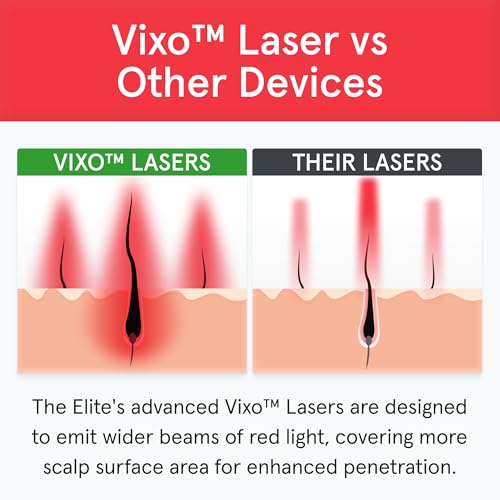 iRESTORE Elite Laser Hair Growth System - World's Best FDA Cleared Red Light Therapy Cap for Hair Regrowth - Hair loss Treatment for Men & Women