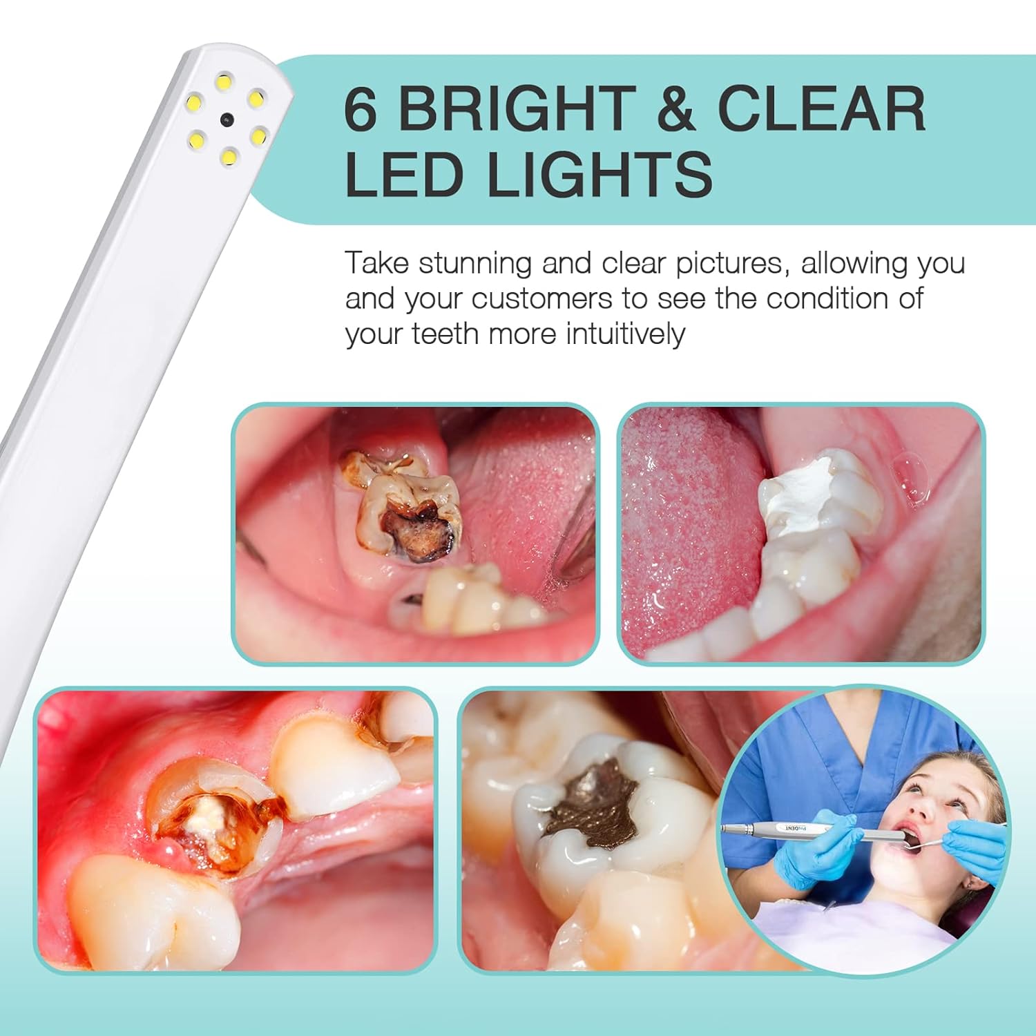 Intraoral Camera PD740, Capture Button Driver to Work with Eaglesoft, Dexis, Apeteryx, Carestream, Tigerview,