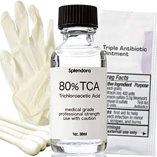 80% TCA Acid Peel (1 oz.) Skin Peel Acid - Tattoo Removal, Remove Skin Tags, Moles, Age Spots, Stretch Marks, Acne Scars, Scars,