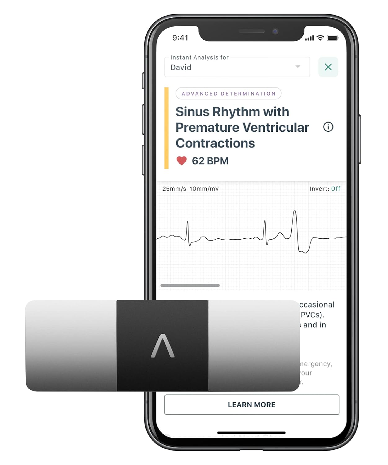 AliveCor KardiaMobile 6L Personal EKG Device and Heart Monitor | Detect AFib and PVCs from Home | 6 Arrhythmia Detections with KardiaCare (Includes 1