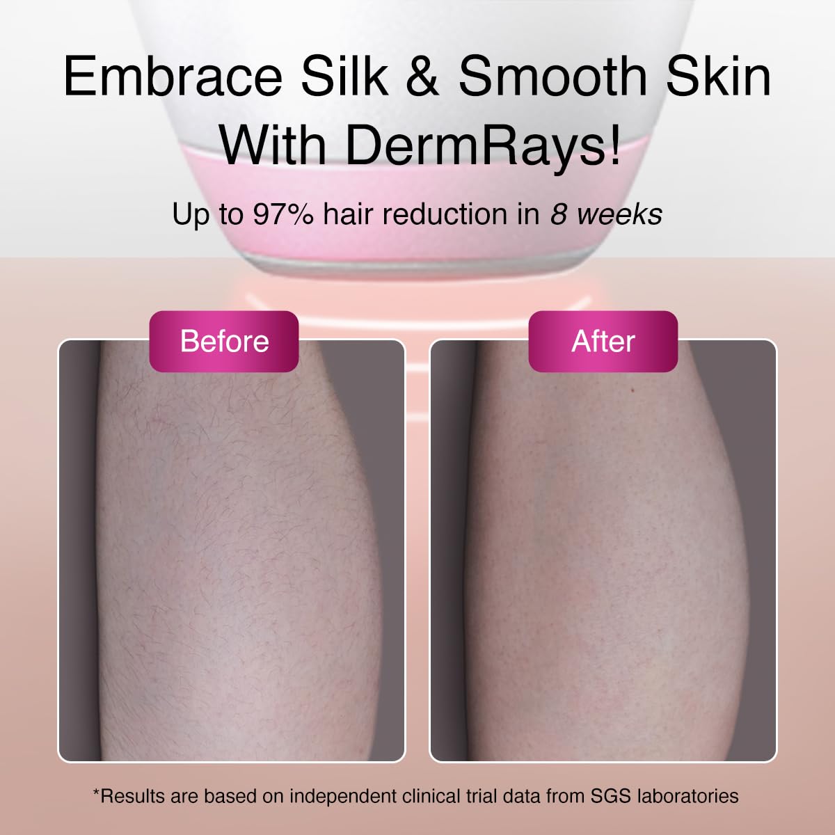 Upgrated Diode Laser Hair Removal for Dark Skin Tones, DermRays 1064nm Laser Hair Removal, Permanent Reduction in Hair Regrowth for Women and Men