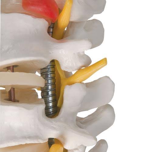 3B Scientific A59/1 Highly Flexible Spine Model