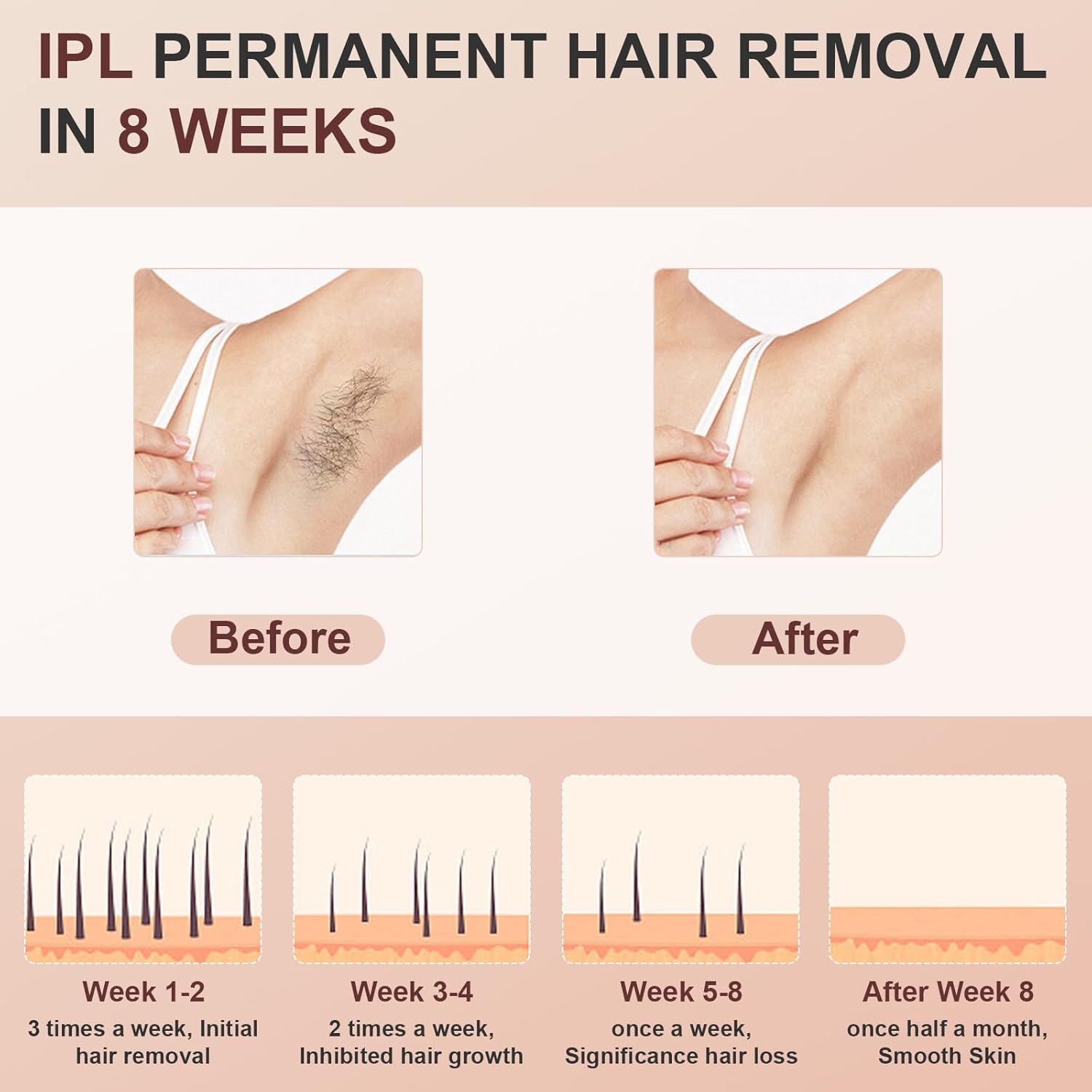 IPL Laser Hair Removal for Women and Men, Permanent and Painless Hair Removal Device