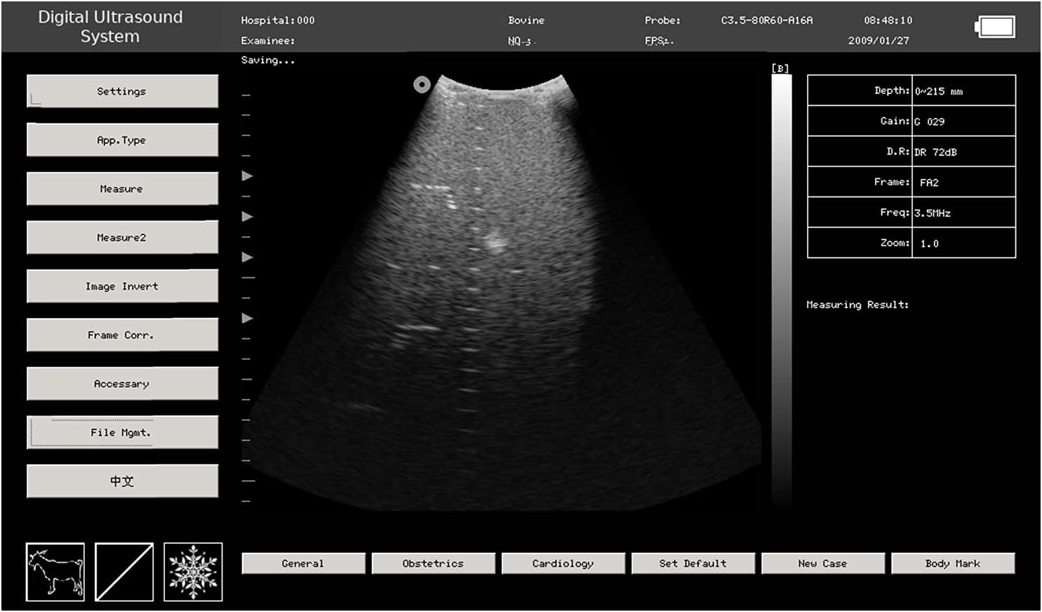 CONTEC USA Veterinary Laptop Machine Ultrasound Scanner Newest Horse/Equine/Cow/Sheep use (Convex & Rectal Linear Probe)