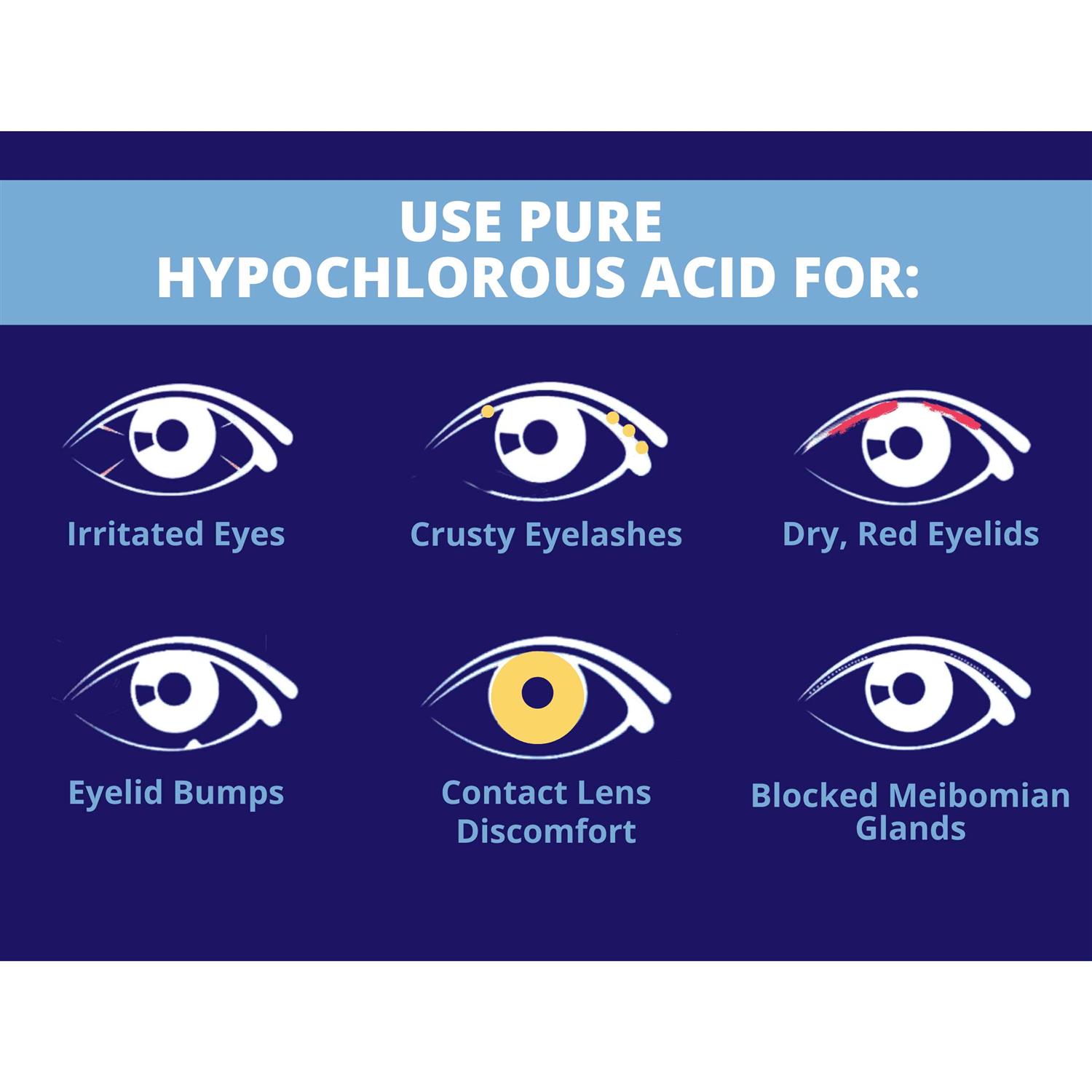 Heyedrate Lid and Lash Cleanser for Eye Irritation and Eyelid Relief - Pet Supplies online store