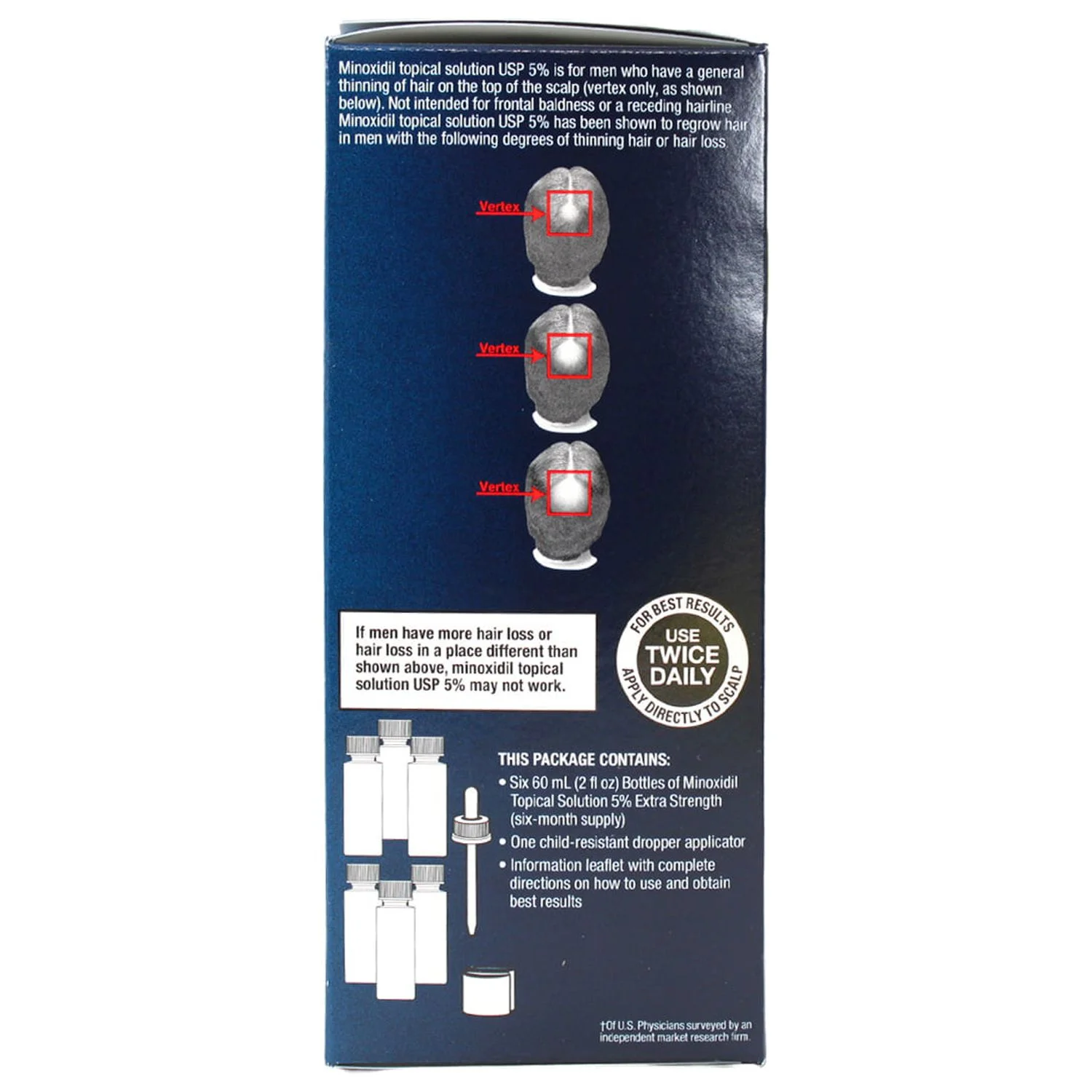 12 Months Kirkland DROP MINOXIDIL 5% Mens Hair Loss Regrowth Treatment