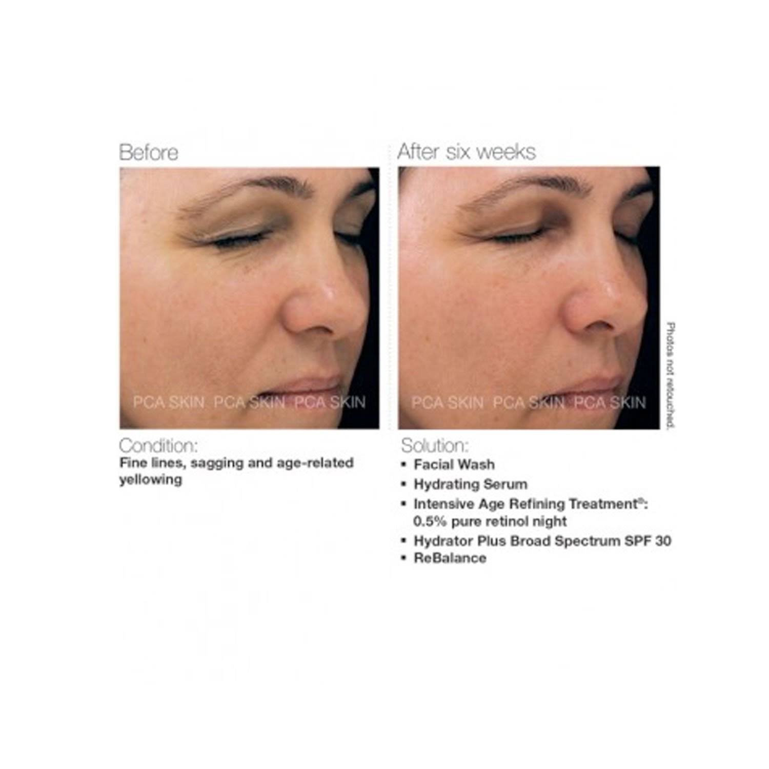 PCA Skin Intensive Age Refining Treatment : 0.5% Pure Retinol Night