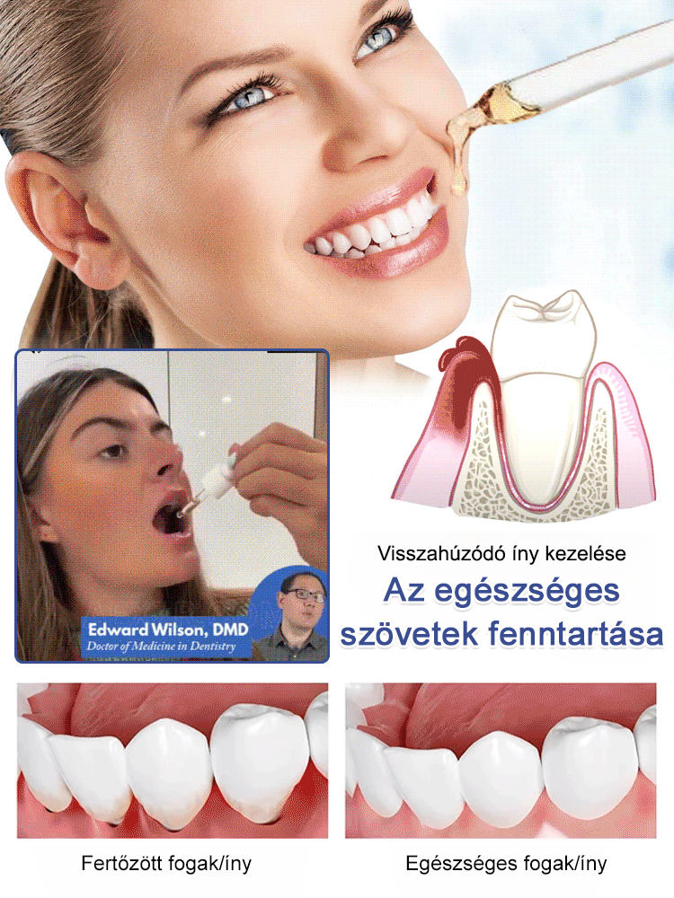 👍Prémium Mélytengeri Fogápoló Cseppek | Fogkő Eltávolítás & Fehérítés Otthon | Azonnali Friss Lehelet & Makacs Foltok Ellen