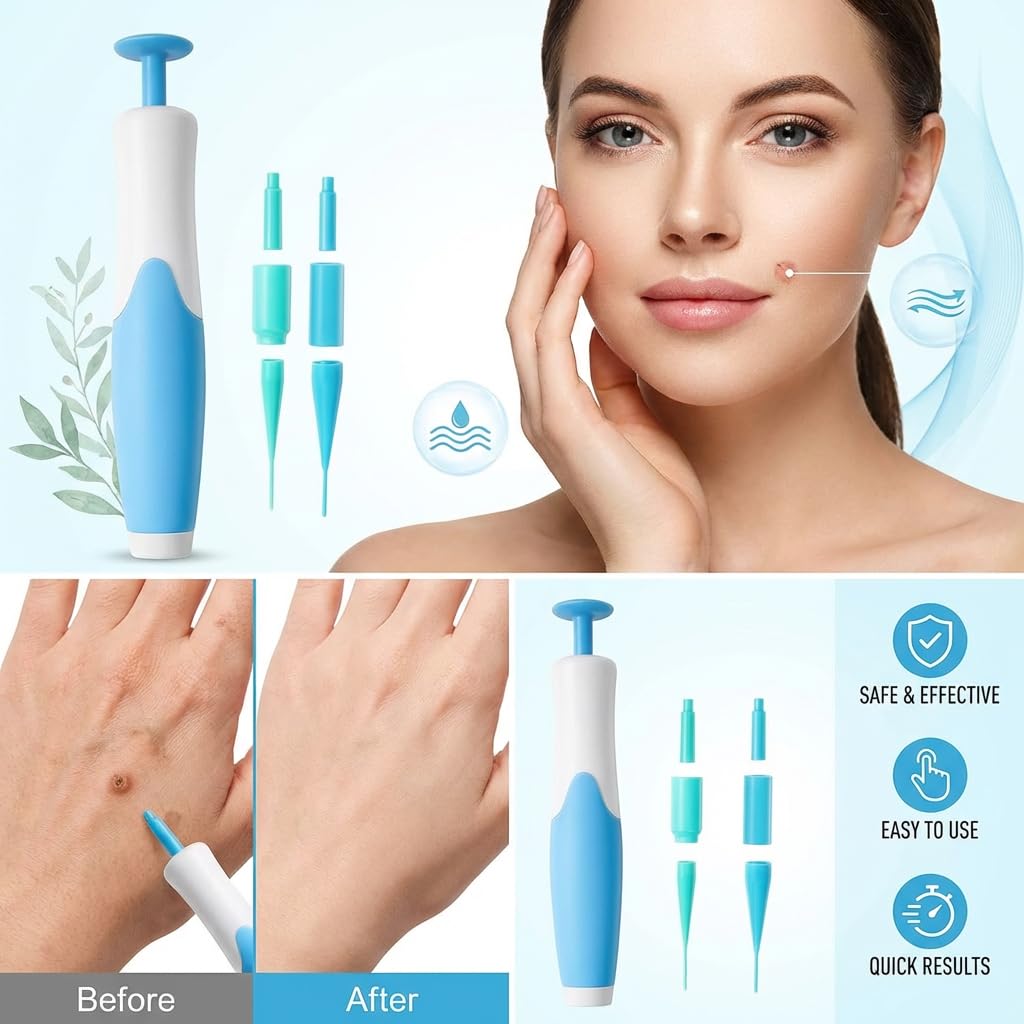 Eantas ALCURA Komplett Set Bundle