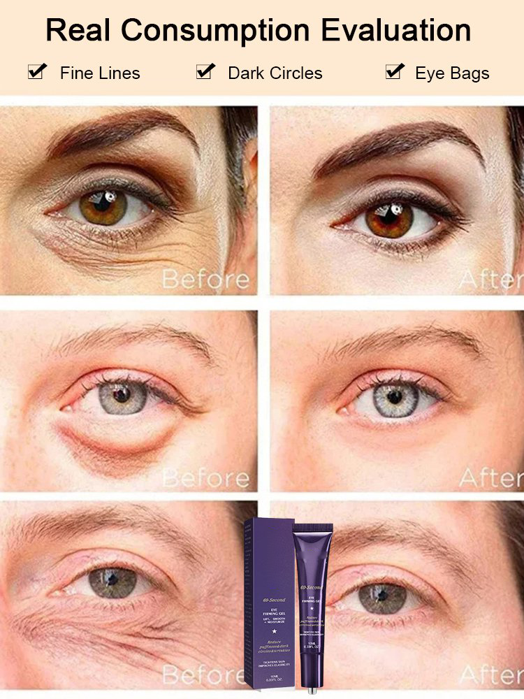Eye gel before and after comparison