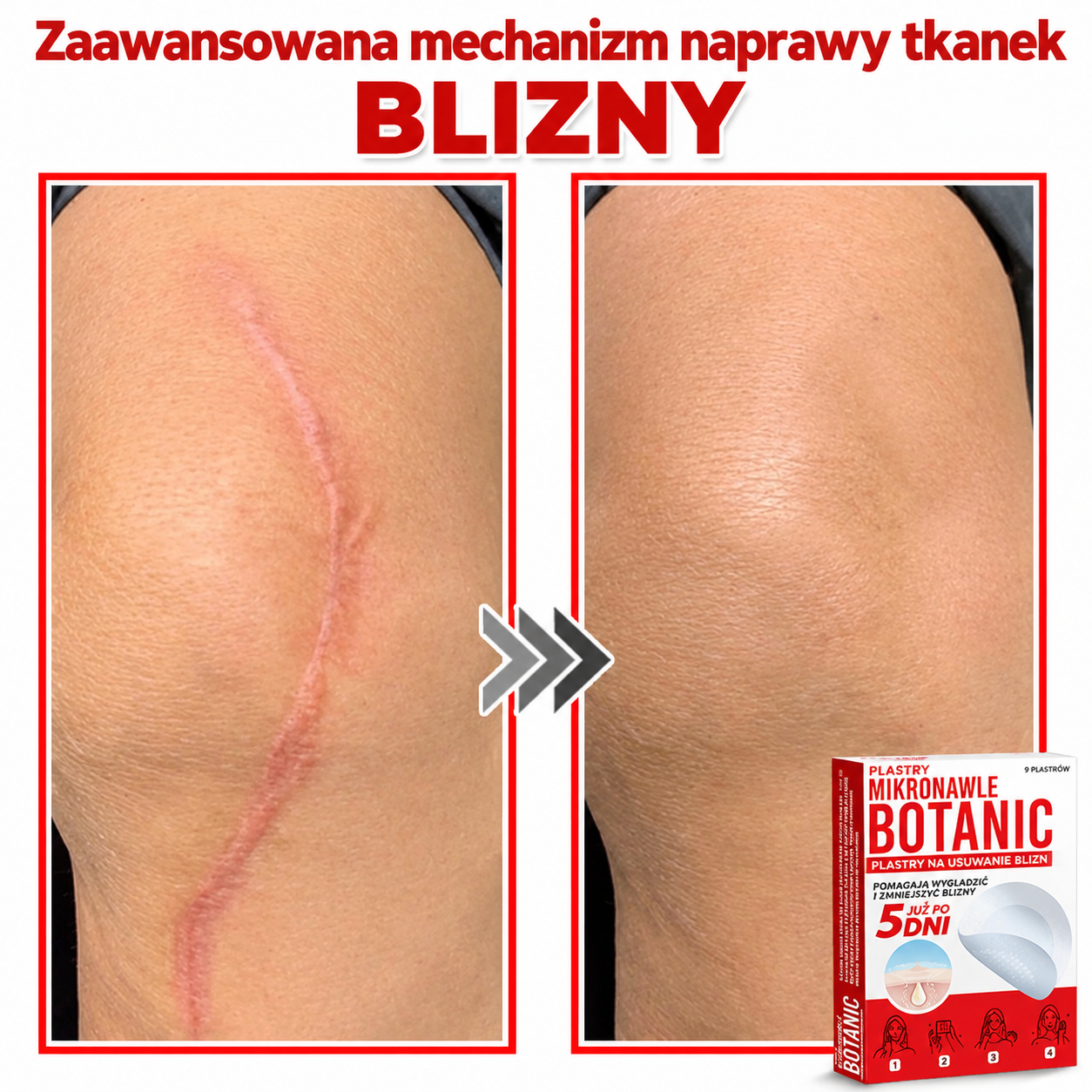 Botaniczny plaster z mikroigłami do usuwania włókniaków skórnych