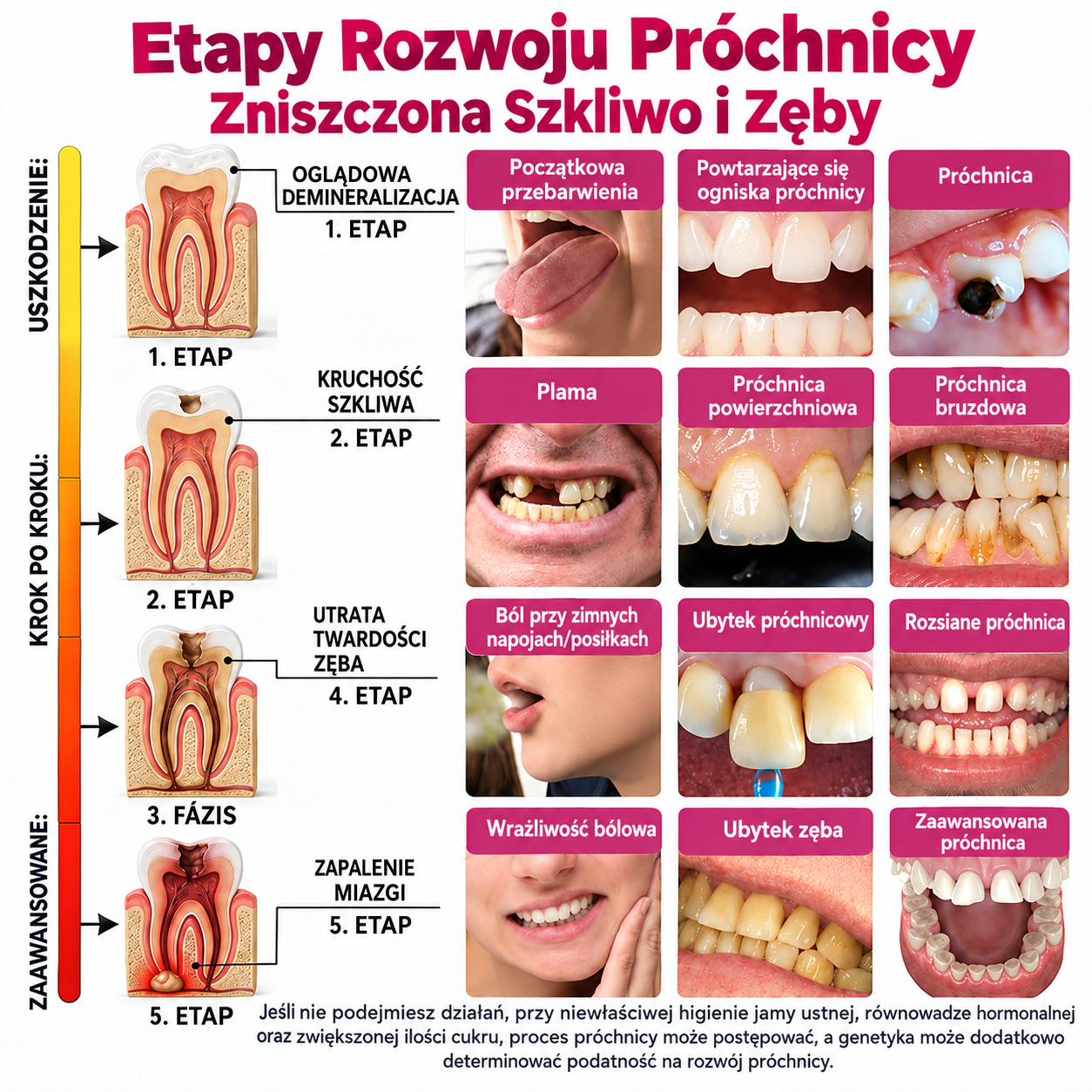 Relimoy® DenPerm – naturalny żel do wypełniania ubytków i odbudowy szkliwa