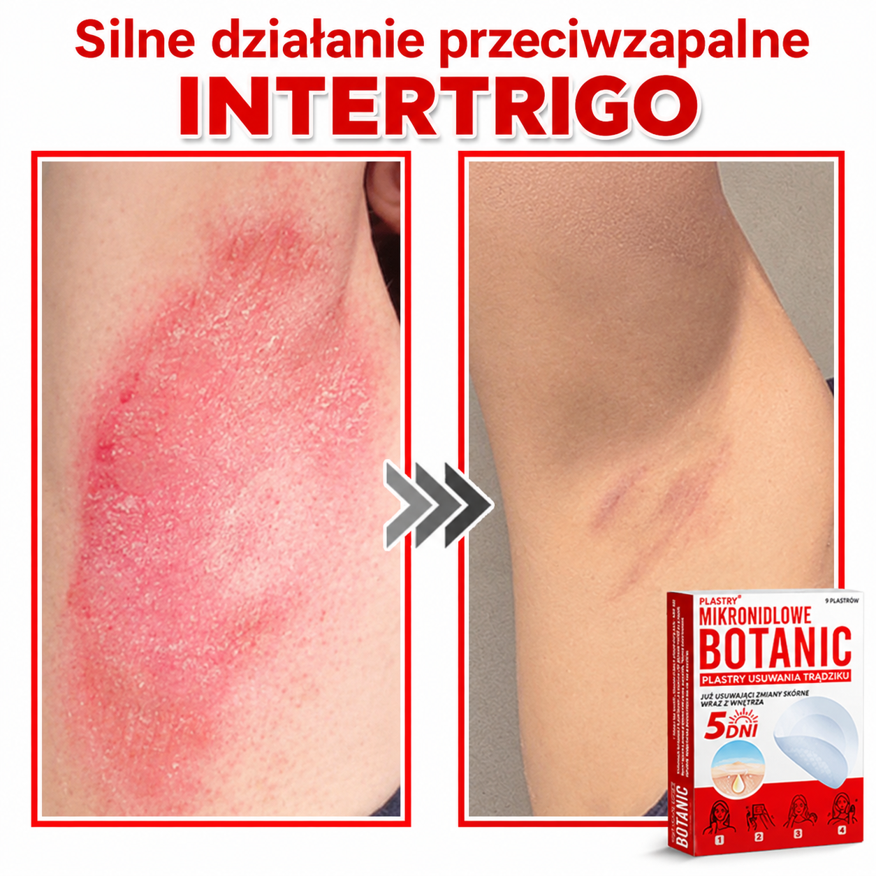 Botaniczny plaster z mikroigłami do usuwania włókniaków skórnych