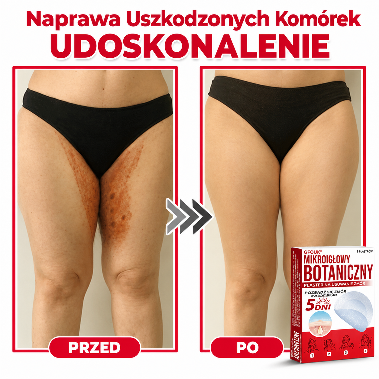 Botaniczny plaster z mikroigłami do usuwania włókniaków skórnych