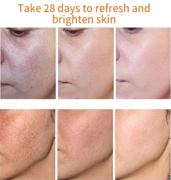 [Oficiální obchod] Bloobeac® Blemish Removing BeautyCream - Zesvětluje tmavé skvrny, pihy a vrásky | Péče proti stárnutí, sjednocující tón pleti