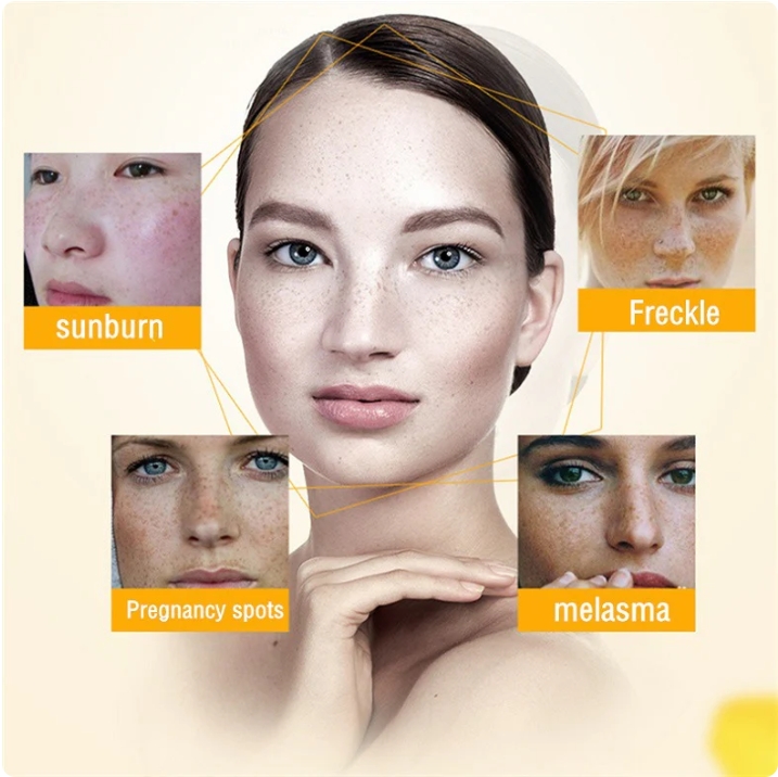 [Oficiální obchod] Bloobeac® Blemish Removing BeautyCream - Zesvětluje tmavé skvrny, pihy a vrásky | Péče proti stárnutí, sjednocující tón pleti
