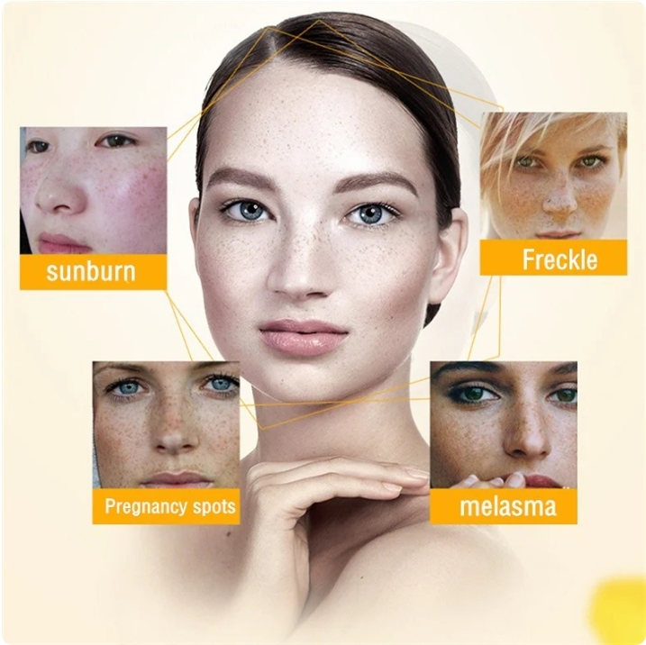 [Oficiální obchod] Bloobeac® Blemish Removing BeautyCream - Zesvětluje tmavé skvrny, pihy a vrásky | Péče proti stárnutí, sjednocující tón pleti