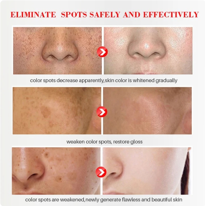 [Oficiální obchod] Bloobeac® Blemish Removing BeautyCream - Zesvětluje tmavé skvrny, pihy a vrásky | Péče proti stárnutí, sjednocující tón pleti