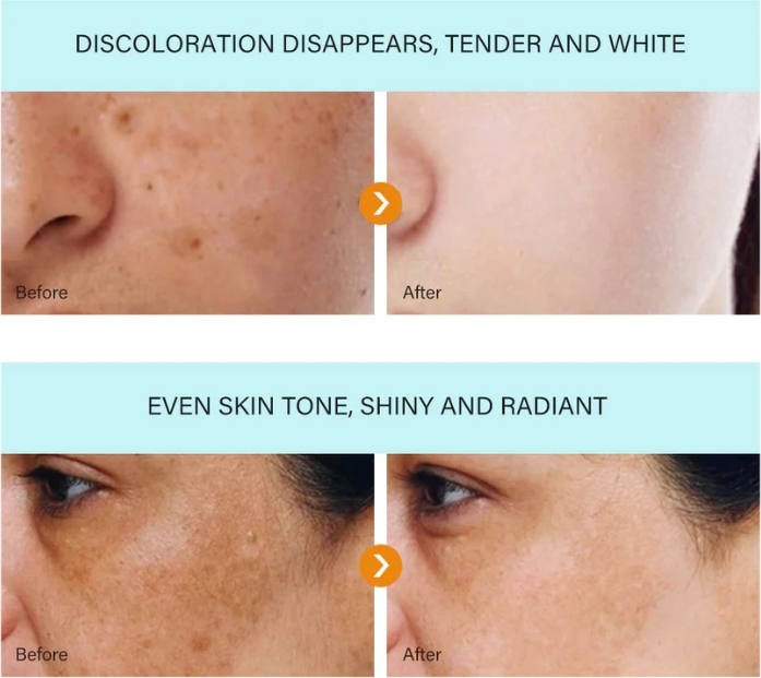 [Oficiální obchod] Bloobeac® Blemish Removing BeautyCream - Zesvětluje tmavé skvrny, pihy a vrásky | Péče proti stárnutí, sjednocující tón pleti