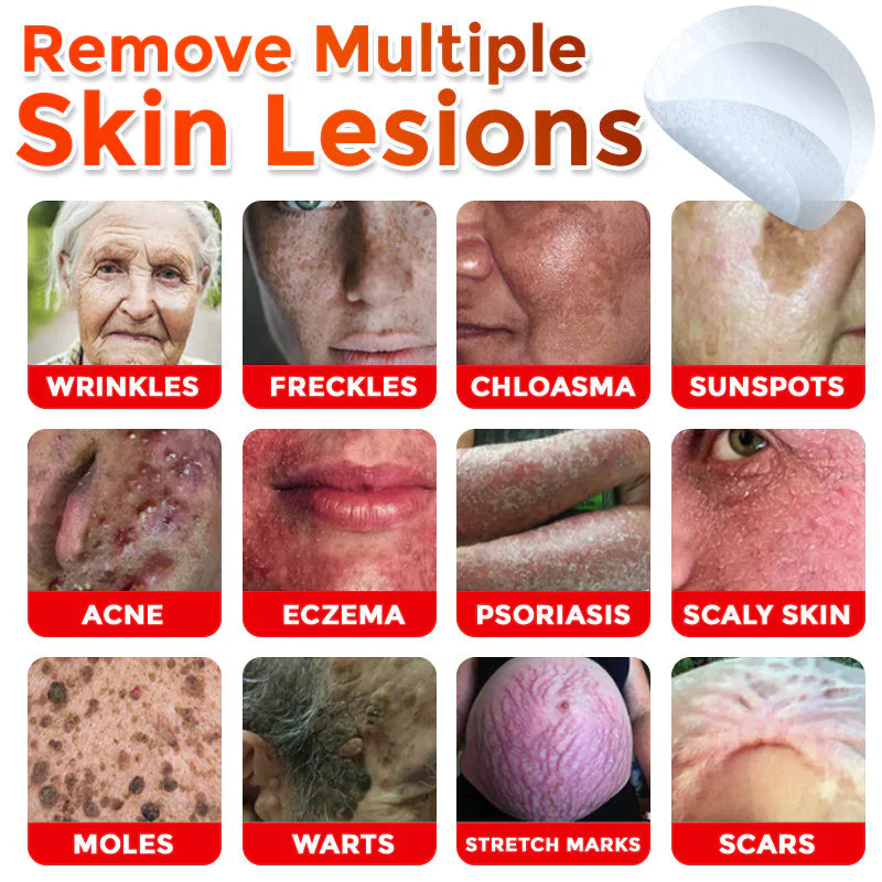 🌈SkinPrikyn™ MicroNeedle Botanic náplast na odstranění kožních výrůstků 🇺🇸 Vyrobeno v USA