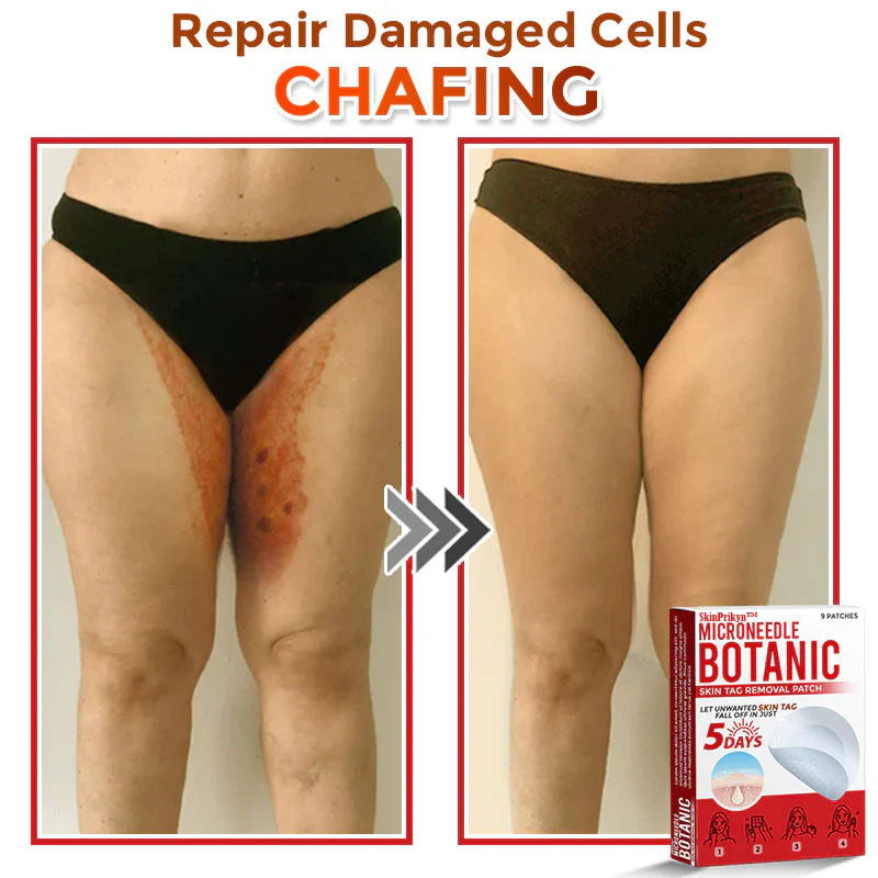 🌈SkinPrikyn™ MicroNeedle Botanic náplast na odstranění kožních výrůstků 🇺🇸 Vyrobeno v USA