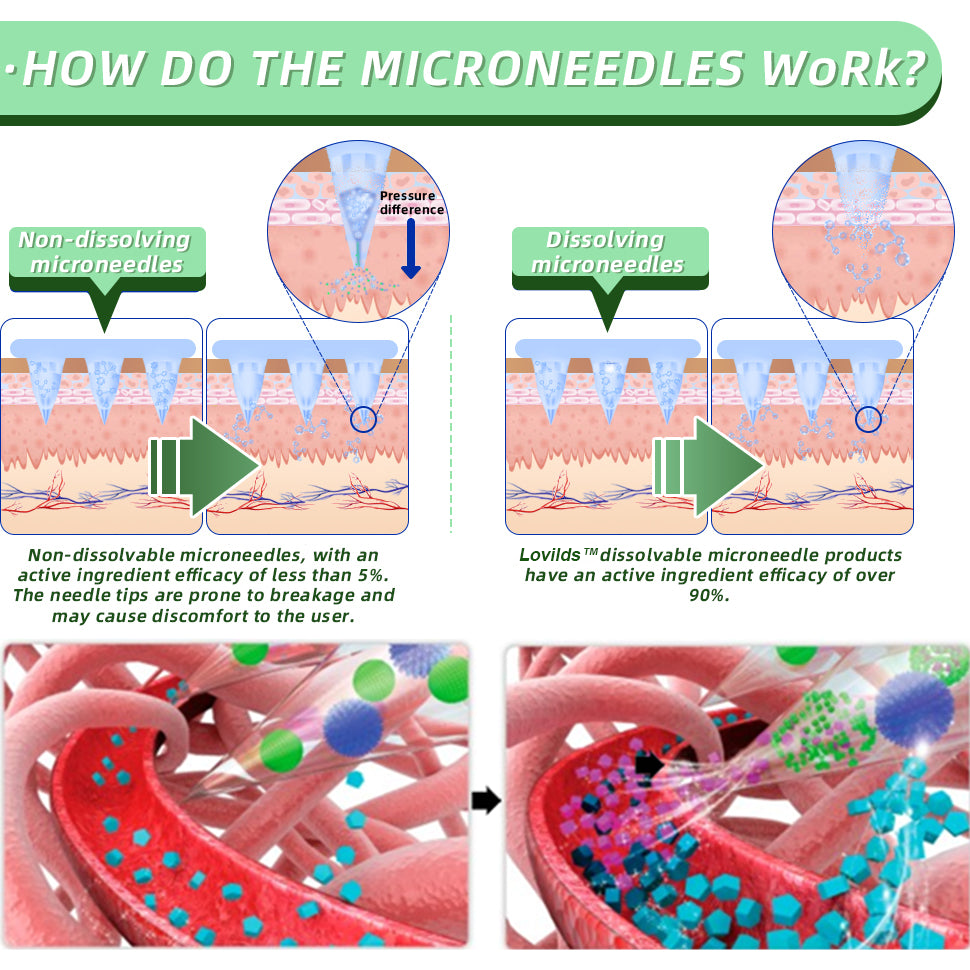 LOVILDS™ SMGT-GLP-1 Nano Microneedle Patch(Painless. long-lasting. addressing diabetes. obesity. and cardiovascular diseases)