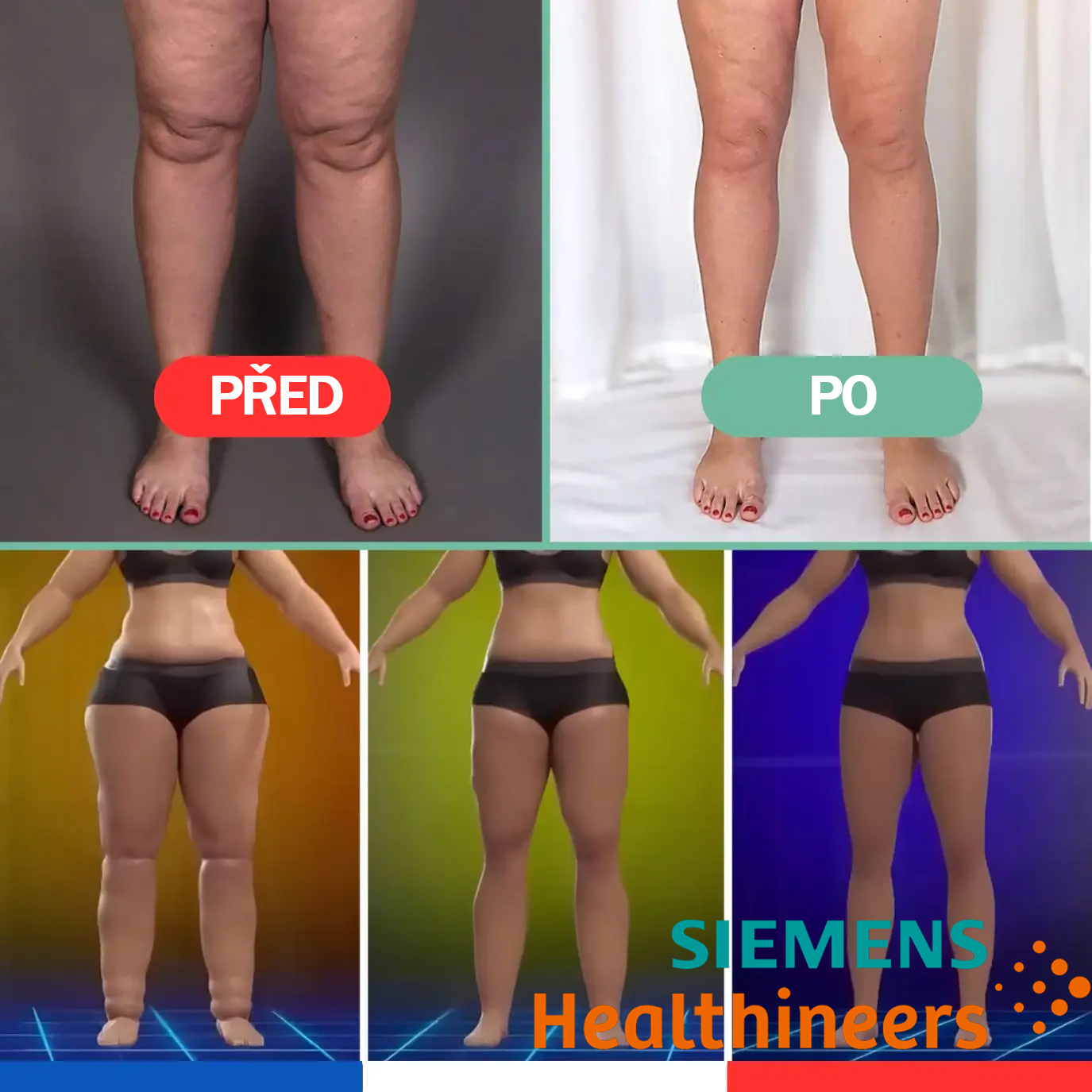 Siemens Healthineers🩺OrthoMasseur terapie 4 v 1🧪Úleva od bolesti🥼domácí léčba