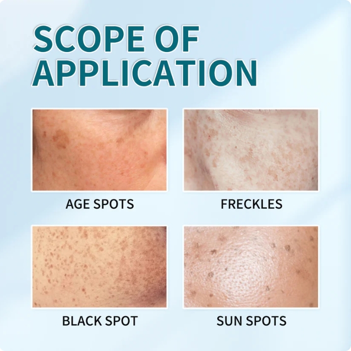 [Oficiální obchod] Bloobeac® Blemish Removing BeautyCream - Zesvětluje tmavé skvrny, pihy a vrásky | Péče proti stárnutí, sjednocující tón pleti