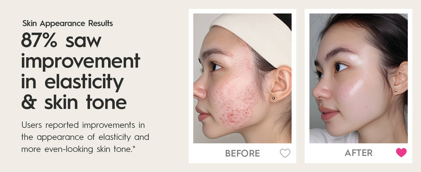 87% saw improvement in elasticity &amp;amp; skin tone