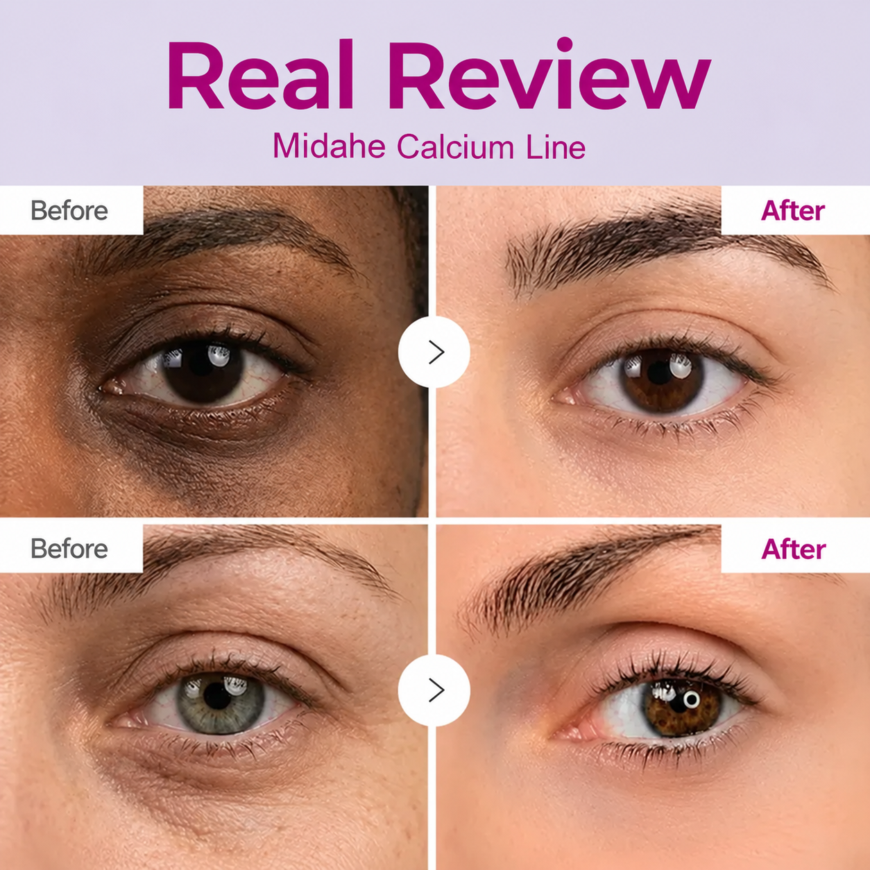 LAST DAY 50% OFF!! Prisolite Korean Calcium Dark Spot Eye Cream