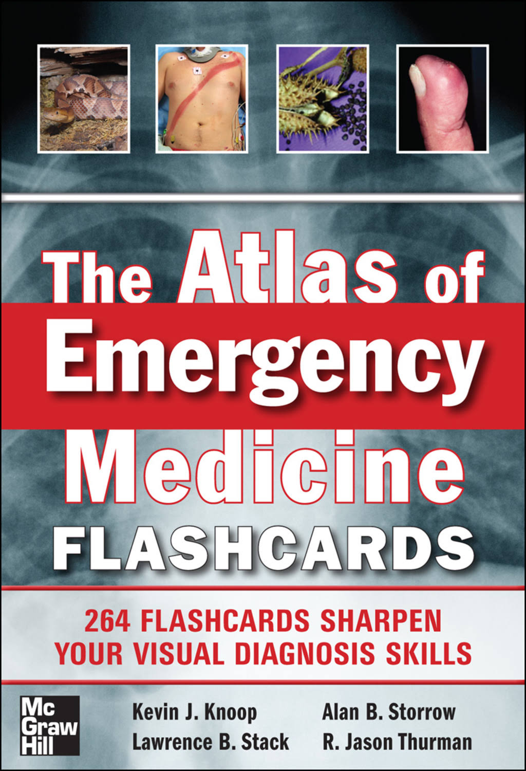 The Atlas of Emergency Medicine Flashcards [eBook]