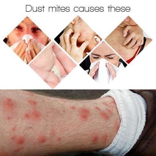 🔥Dust Mite Killing Pad