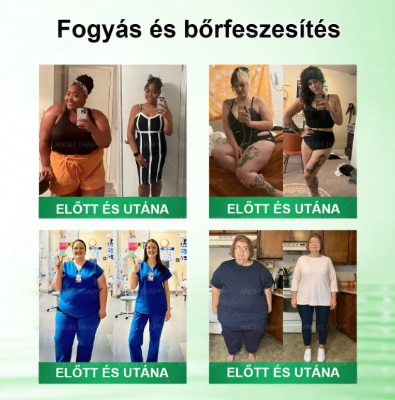 👍ANGELTRAP@Moringa x Berberine xAMPK 10 az 1-ben anyagcsere-támogató nanotűs tapasz (Naponta egy tapasz, 7 napon belül látható változások) HU✅ Különböző állapotok, például elhízás, cukorbetegség, alvási apnoe és emésztési problémák esetén alkalmazható.
