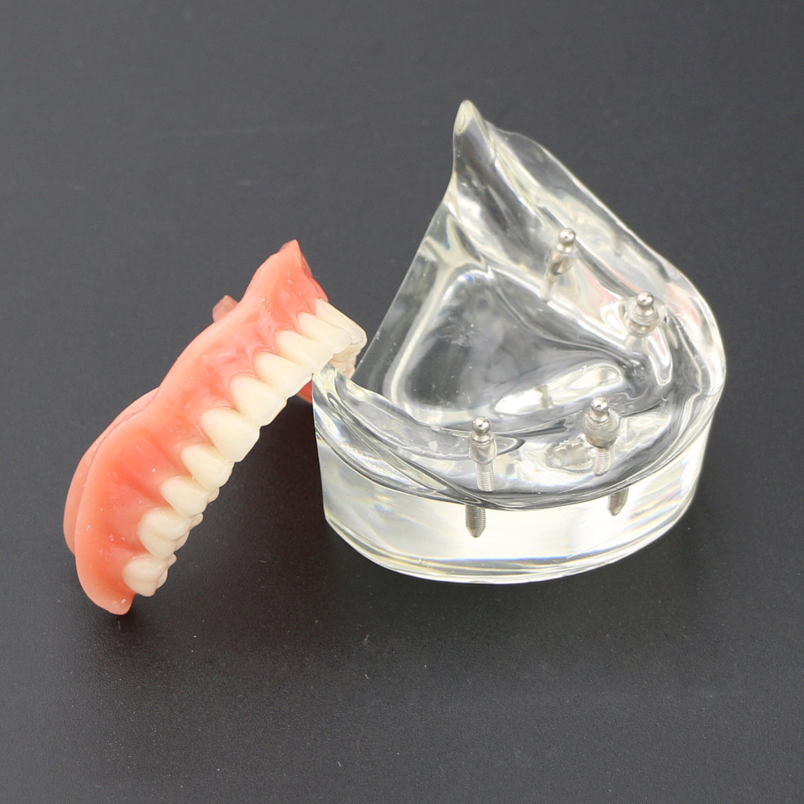 Professional Dental Lower Teeth Demo Study Model 6002 02 Overdenture Inferior 4 Implants image 2
