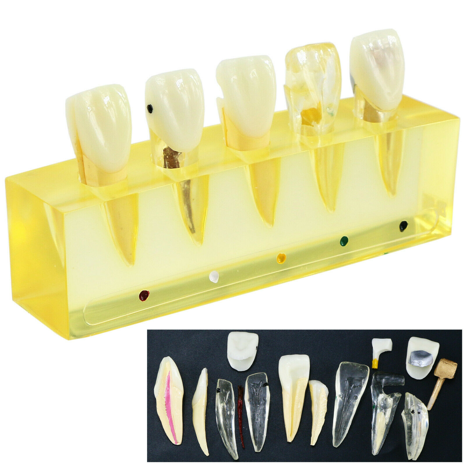 Professional Dental Teeth Model 5Stages Demonstration Endodontic Treatment Root Canal Incisor image 2