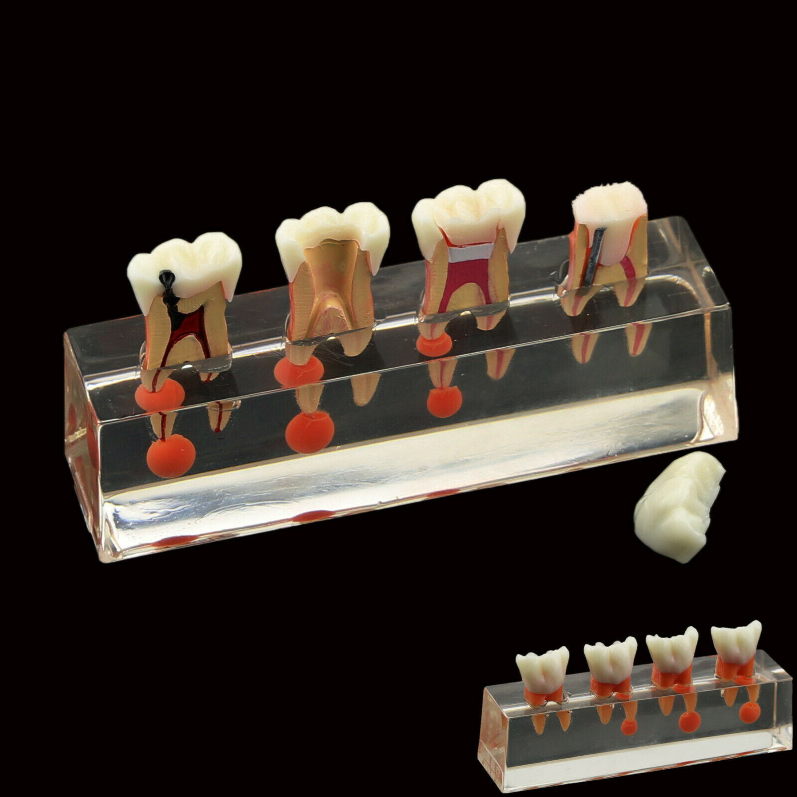 Professional Dental Teeth Model 4-Stage Endodontic Treatment Demonstrates Anatomical M4018 image 2