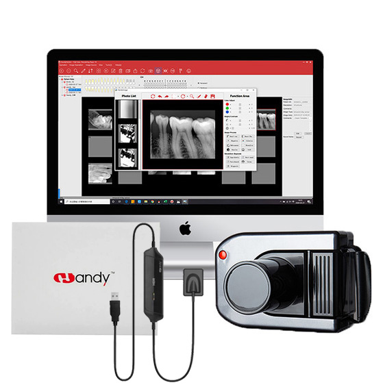 Portable Dental X Ray Unit AD-60P with Handy HDR 600a Dental X-Ray Sensor Kit image 2