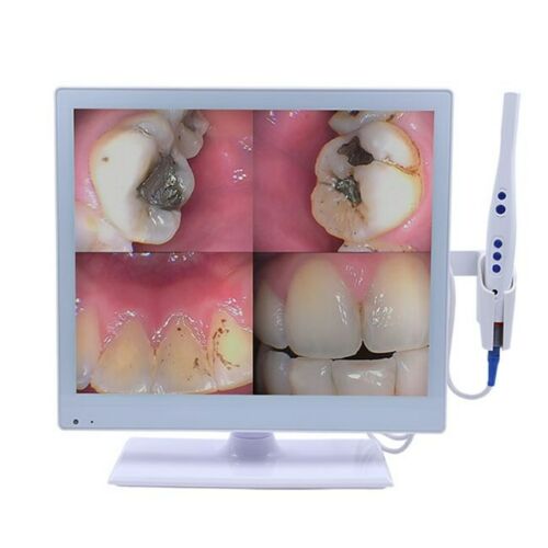 Professional Dental 2-in-1 Wired Intraoral Camera with 17 Inch LED Monitor M-978 HDMI USB VGA image 2