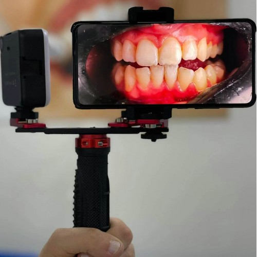 Professional Dental Adjustment Oral Photography Flash Light Mobile Phone Dental Photography Fill Light image 1