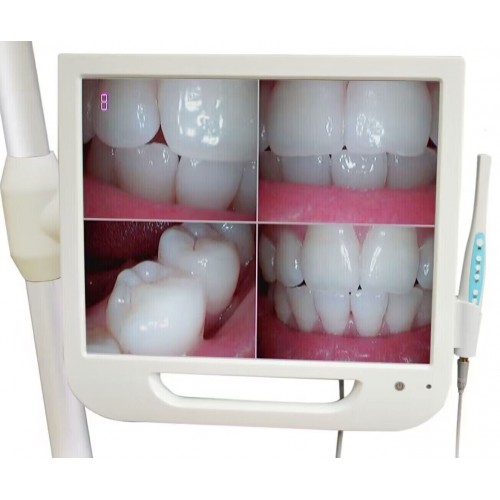 17 Inch Digital LCD AIO Monitor Professional Dental Intra Oral Camera image 1