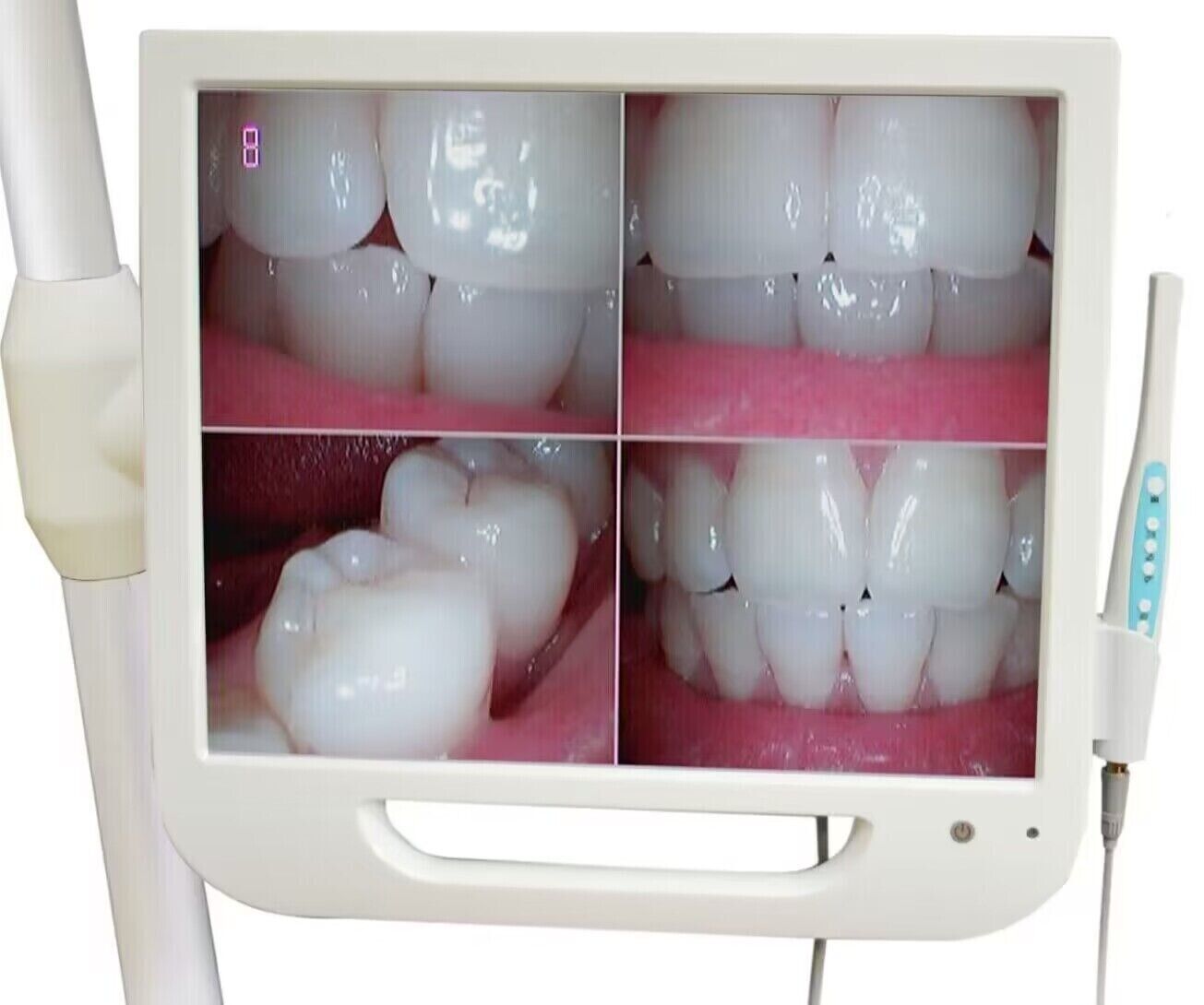 17 Inch Digital LCD AIO Monitor Professional Dental Intra Oral Camera image 2