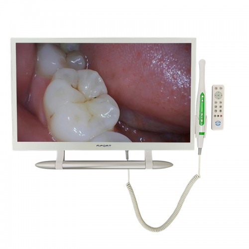 YF-2200M 21.5 Inch Dental HD Intraoral Camera with Monitor Screen and Bracket Holder Kit for Dental Chair Unit image 1