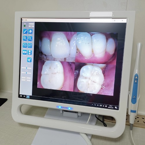 YF-1700P with 17 Inch Dental Intraoral Camera Touch LCD Screen for Dental Unit and Bracket 6-Piece LEDS 8.0 Mega Pixels image 1
