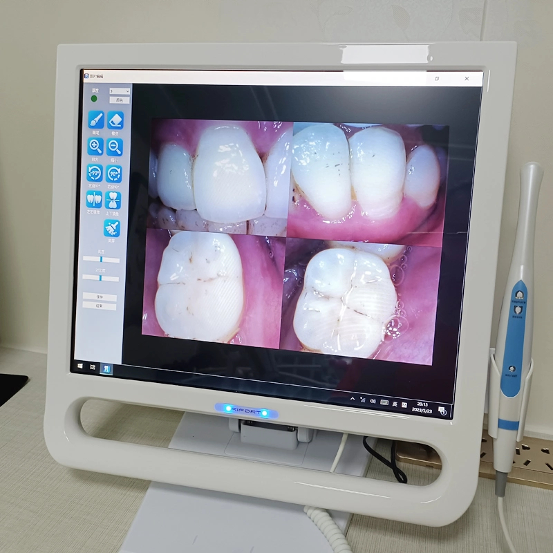 YF-1700P with 17 Inch Dental Intraoral Camera Touch LCD Screen for Dental Unit and Bracket 6-Piece LEDS 8.0 Mega Pixels image 2
